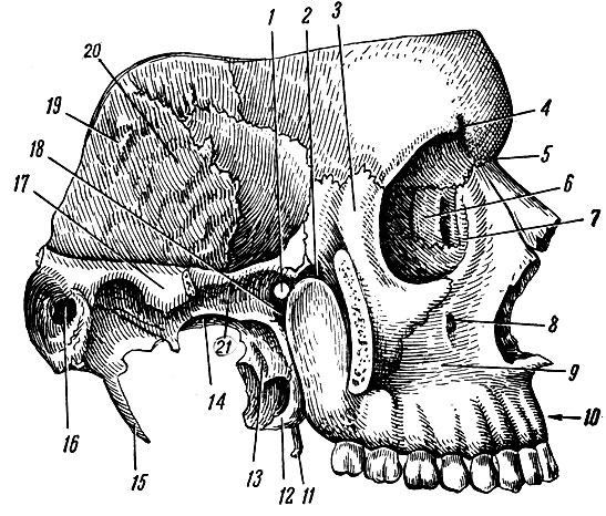 Рис. 47. Височная, подвисочная и крыло-небная ямки, вид справа (скуловая дуга удалена). 1 - foramen sphenopalatinum; 2 - fissura orbitalis inferior; 3 - processus frontalis скуловой кости; 4 - incisura supraorbital; 5 - pars nasalis ossis frontalis; 6 - os lacrimale; 7 - fossa sacci lacrimalis; 8 - foramen infraorbitale; 9 - fossa canina; 10 - processus alveolaris; 11 - hamulus proc. pterygoidei; 12 - processus pyramidalis ossis palatini; 13 - lamina lateralis proc. pterygoidei; 14 - foramen ovale; 15 - processus styloideus; 16 - meatus acusticus externus; 17 - processus zygomaticus ossis temporalis; 18 - fossa pterygopalatine; 19 - pars squamosa ossis temporalis; 20 - височная ямка; 21 - подвисочная ямка