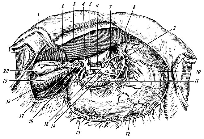 Рис. 155. Чревный ствол и его ветви. 1 - lig. teres hepatis; 2 - a. cystica; 3 - левая доля печени; 4, 16 - ductus choledochus; 5 - v. portae; 6 - v. cava inferior; 7 - a. gastrica sinistra; 8 - truncus coeliacus; 9 - aorta abdominalis; 10 - желудок; 11 - pancreas; 12 - a. gastroepiploica sinistra; 13 - a. gastroepiploica dextra; 14 - a. lienalis; 15 - a. hepatica communis; 17 - ductus cysticus; 18 - ductus hepaticus communis; 19 - правая доля печени; 20 - vesica fellea