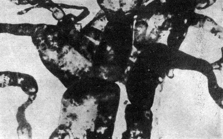 Рис. 177. Сплетение лимфатических сосудов