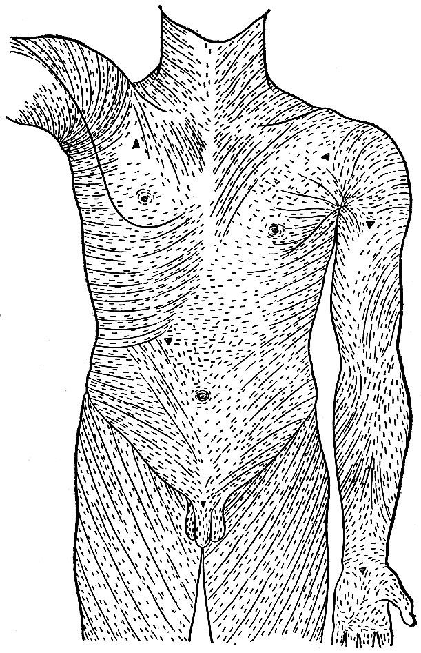 Рис. 259. Направление линий кожи