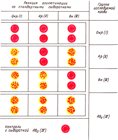 http://neonatology.narod.ru/surgery/blood_reactions.png