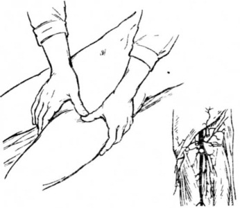 http://larece.ru/wp-content/uploads/2010/10/ab5.jpg