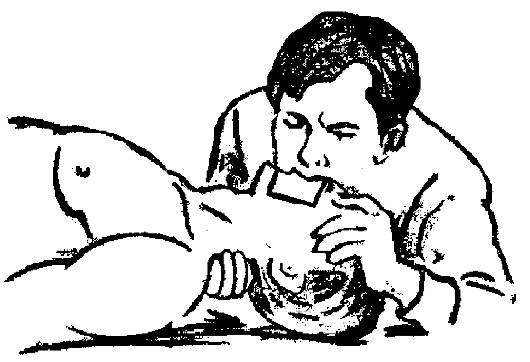 http://vmede.org/sait/content/Obwij_uhod_xir_shev4enko_2009/8_files/mb4_017.png