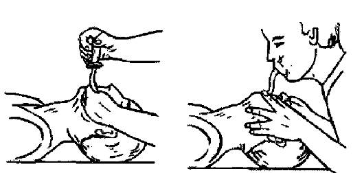 http://vmede.org/sait/content/Obwij_uhod_xir_shev4enko_2009/8_files/mb4_030.png