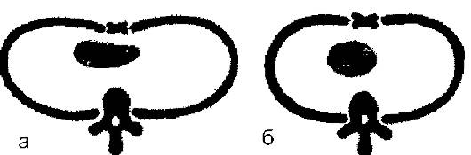 http://vmede.org/sait/content/Obwij_uhod_xir_shev4enko_2009/8_files/mb4_015.png