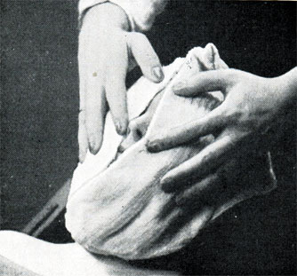 Рис. 355. Безупречное положение полотенца и рук при компрессе лица