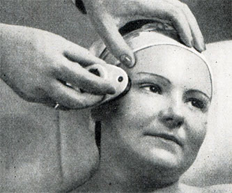 Рис. 381. Утют при втирании питательного или гормонного крема у глаза