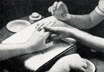 Рис. 394. Смазывание ногтей жиром