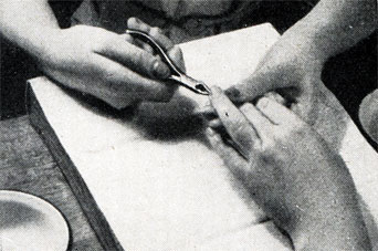 Рис. 398. Стирание кожицы салфеткой