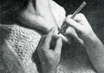 Рис. 415. Обработка мозоля
