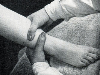 Рис. 421. Массажный прием для сохранения тонкости ног
