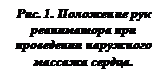 Подпись: Рис. 1. Положение рук реаниматора при проведении наружного массажа сердца.