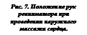 Подпись: Рис. 7. Положение рук реаниматора при проведении наружного массажа сердца.