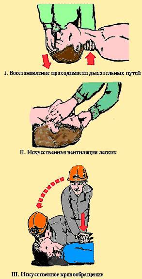искусственное дыхание